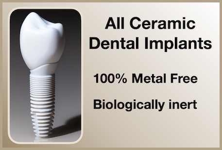 ceramic implant side panel small